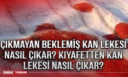 Çıkmayan Beklemiş kan lekesi nasıl çıkar? Kıyafetten kan lekesi nasıl çıkar?