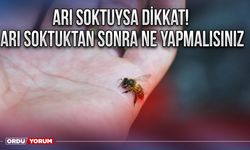 Arı soktuysa dikkat! Arı soktuktan sonra ne yapmalısınız