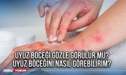 Uyuz böceği gözle görülür mü? Uyuz böceğini nasıl görebilirim?