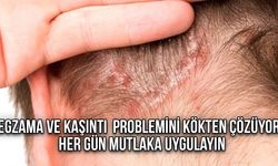 Egzama ve kaşıntı  problemi kökten çözüyor! Her gün mutlaka uygulayın