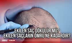 Ekilen saç dökülür mü? Ekilen saçların ömrü ne kadardır?