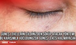 Güneş lekelerini cildinizden söküp atacak yöntem! Bu karışımla vücudunuzda güneş lekesi kalmayacak