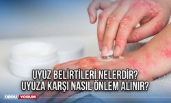 Uyuz Belirtileri Nelerdir? Uyuza Karşı Nasıl Önlem Alınır?