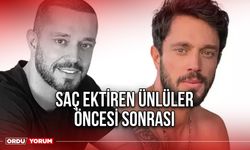 Saç ektiren ünlüler öncesi sonrası