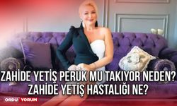 Zahide Yetiş peruk mu takıyor neden? Zahide Yetiş hastalığı ne?