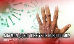 Maymun Çiçeği Türkiye’de Görüldü mü? Sağlık Bakanlığı'ndan Önemli Açıklama! Maymun çiçeği belirtileri, etkileri nelerdir