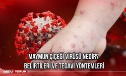 Maymun Çiçeği Virüsü Nedir? Belirtileri ve Tedavi Yöntemleri