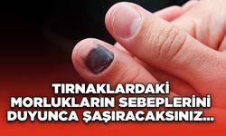 Tırnaklardaki Morlukların Sebeplerini Duyunca Şaşıracaksınız...