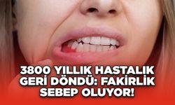 3800 Yıllık Hastalık Geri Döndü: Fakirlik Sebep Oluyor!