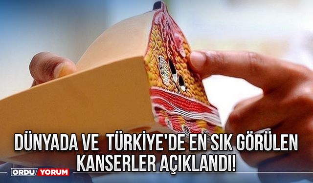 Dünyada ve  Türkiye'de En Sık Görülen Kanserler Açıklandı!