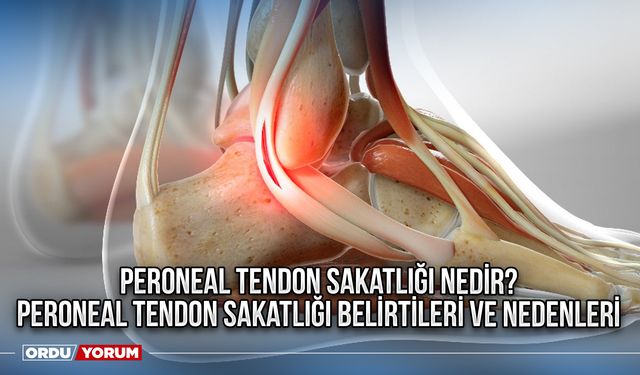 Peroneal tendon sakatlığı nedir? Peroneal tendon sakatlığı belirtileri ve nedenleri