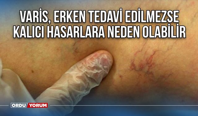 Varis, erken tedavi edilmezse kalıcı hasarlara neden olabilir