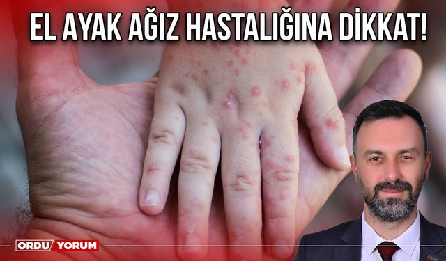 El Ayak Ağız Hastalığına Dikkat!