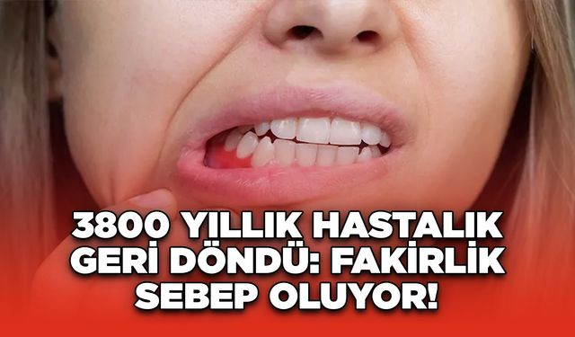 3800 Yıllık Hastalık Geri Döndü: Fakirlik Sebep Oluyor!