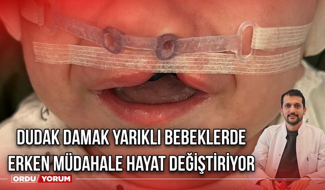 Dudak Damak Yarıklı Bebeklerde Erken Müdahale Hayat Değiştiriyor